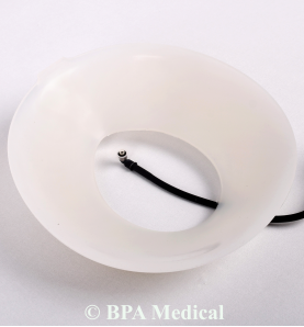 Large Vacuum Bell 26 cm – Class 1 Device for Pectus Excavatum Correction