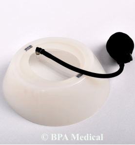 Small Vacuum Bell 19 cm – Chest Vacuum Device for Pectus Excavatum Therapy