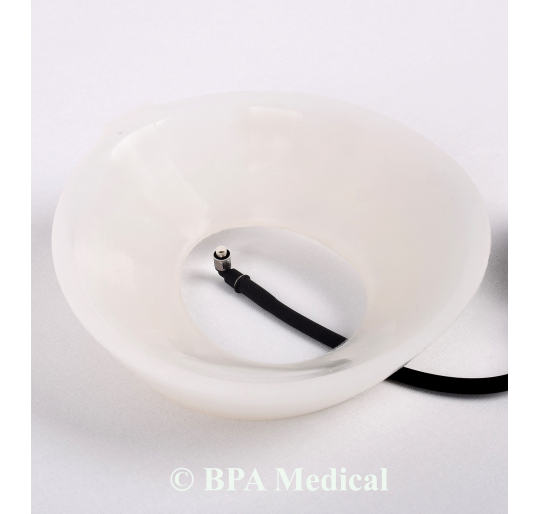 Small Vacuum Bell 19 cm – Chest Vacuum Device for Pectus Excavatum Therapy